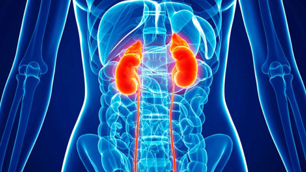 Acute Kidney Injury (AKI)