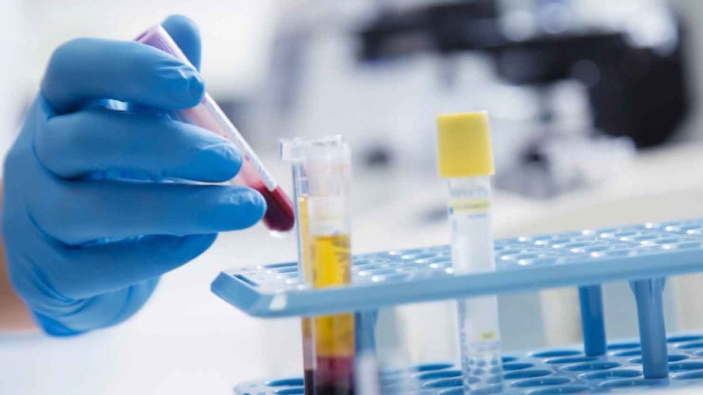 Blood in Urine