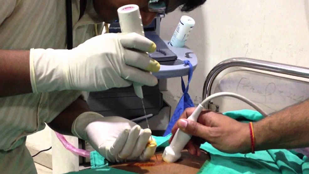 Kidney Biopsy, FKP Comprehensive Kidney Care