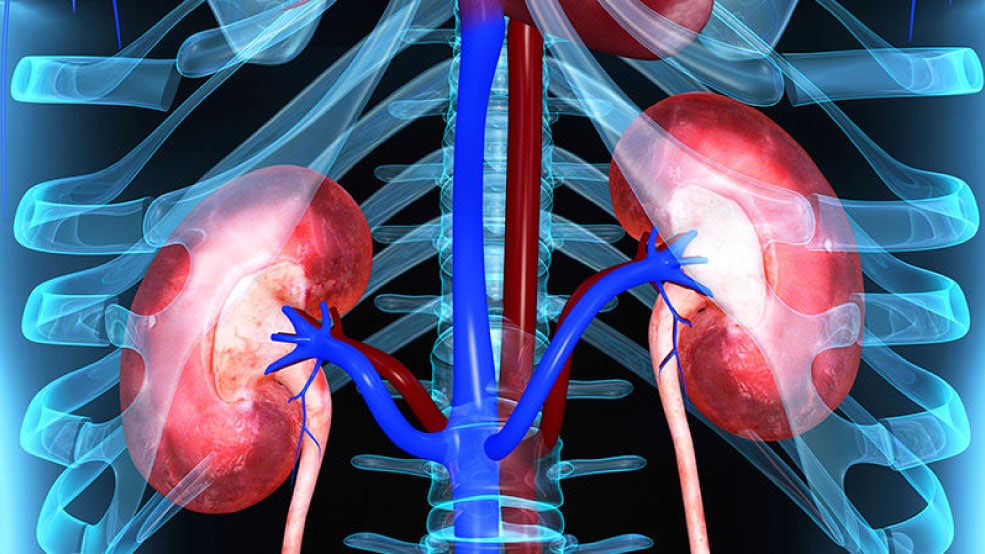 Kidney Infection Causes