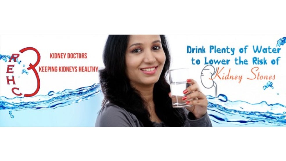 Water Challenge, Kidney Stones Prevention