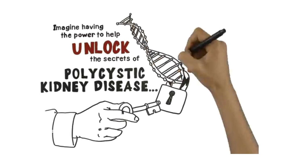 Polycystic Kidney Disease Inheritance (PKD)