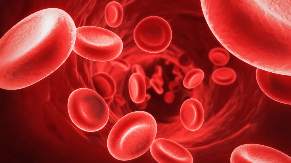Treating Anemia