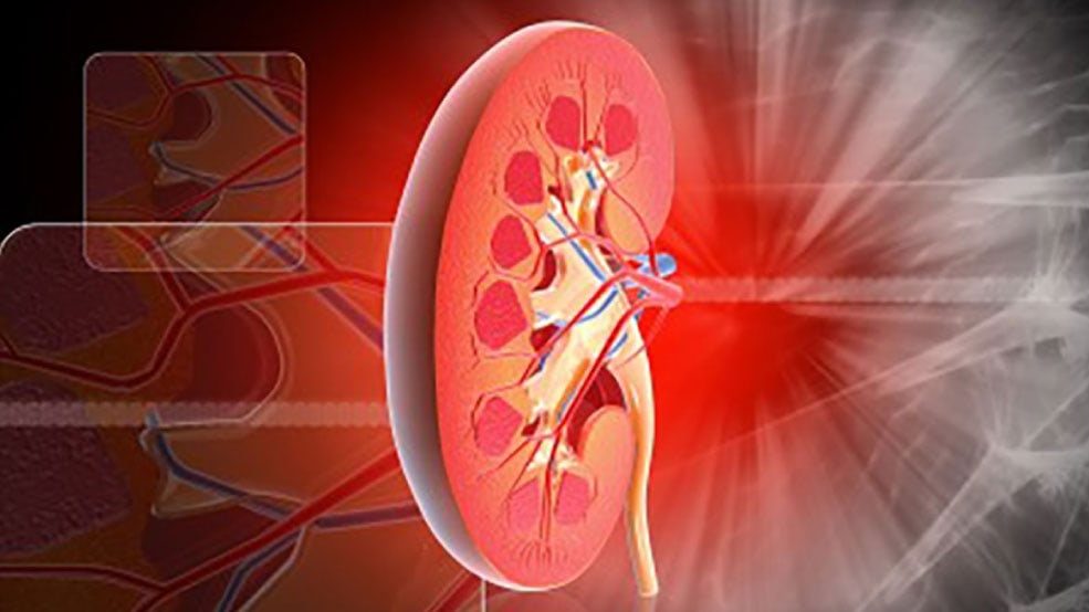 What can you do for your kidneys?