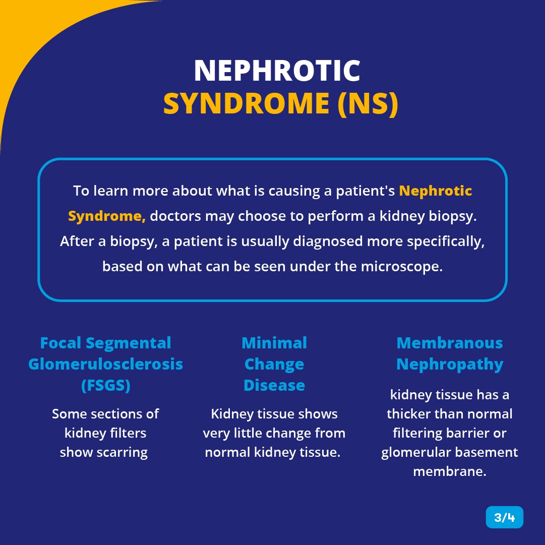 Nephrotic Syndrome