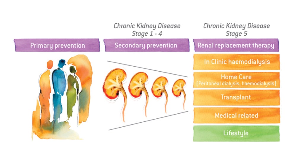 Chronic Kidney Disease Stage 5, Uremic Symptoms | FKP