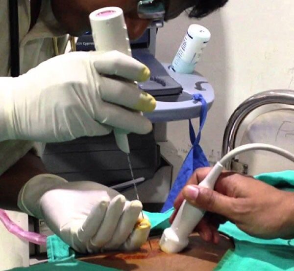 kidney biopsy