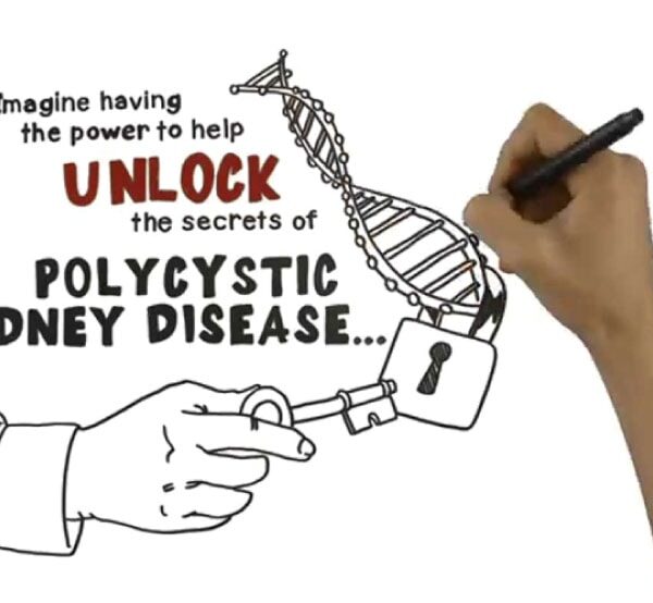 policystic kidney disease PKD